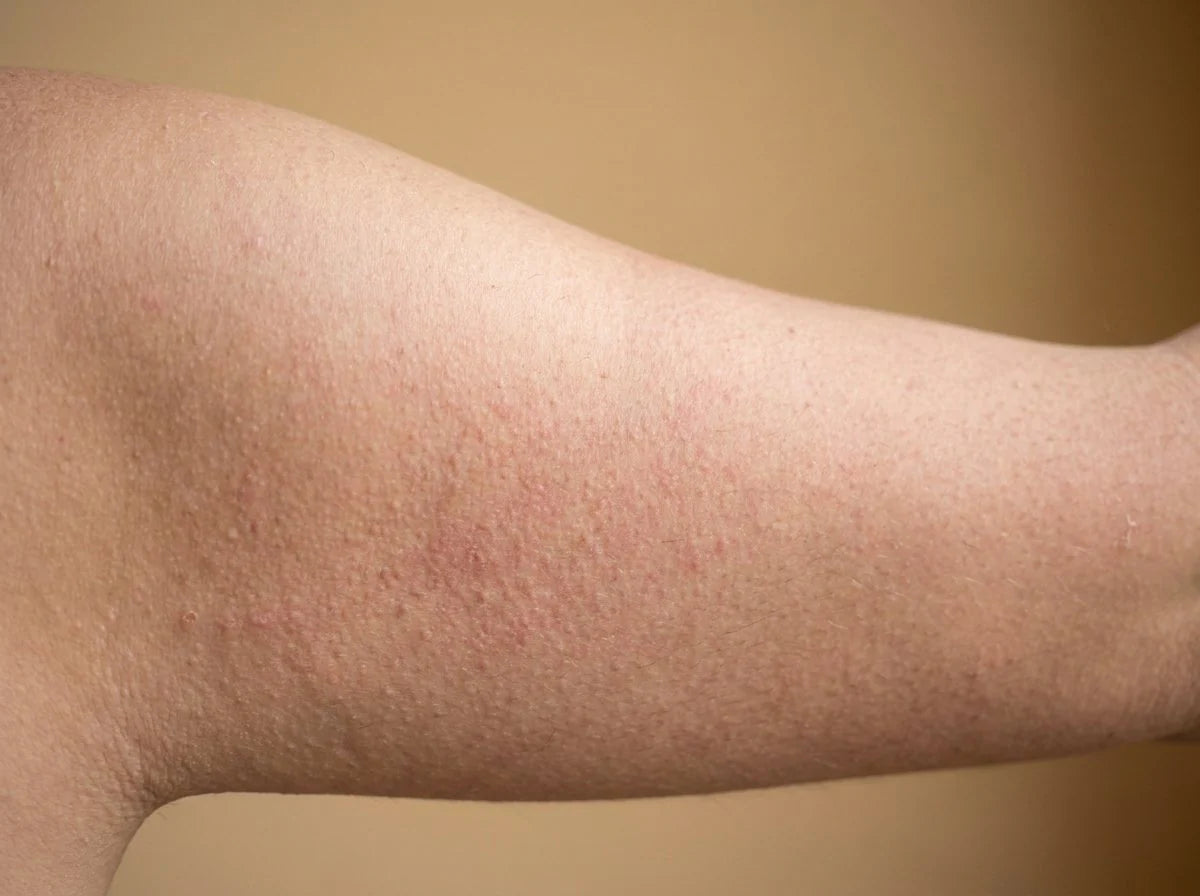 Before — bumpy, uneven skin