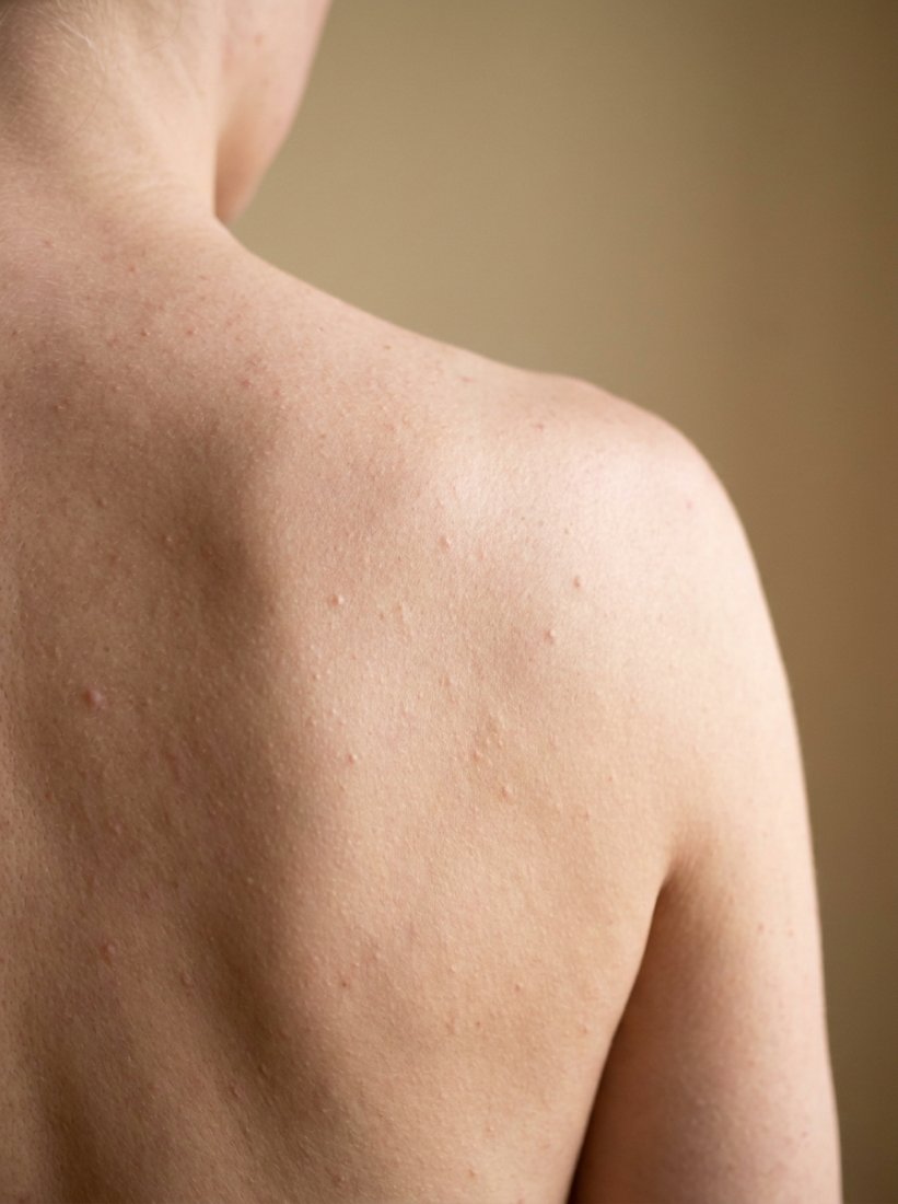Emily · shoulders