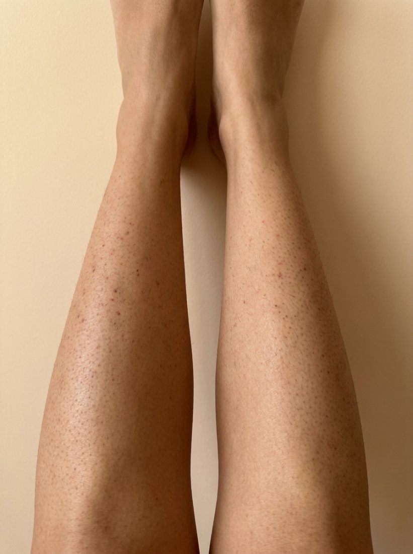 Renata · calves