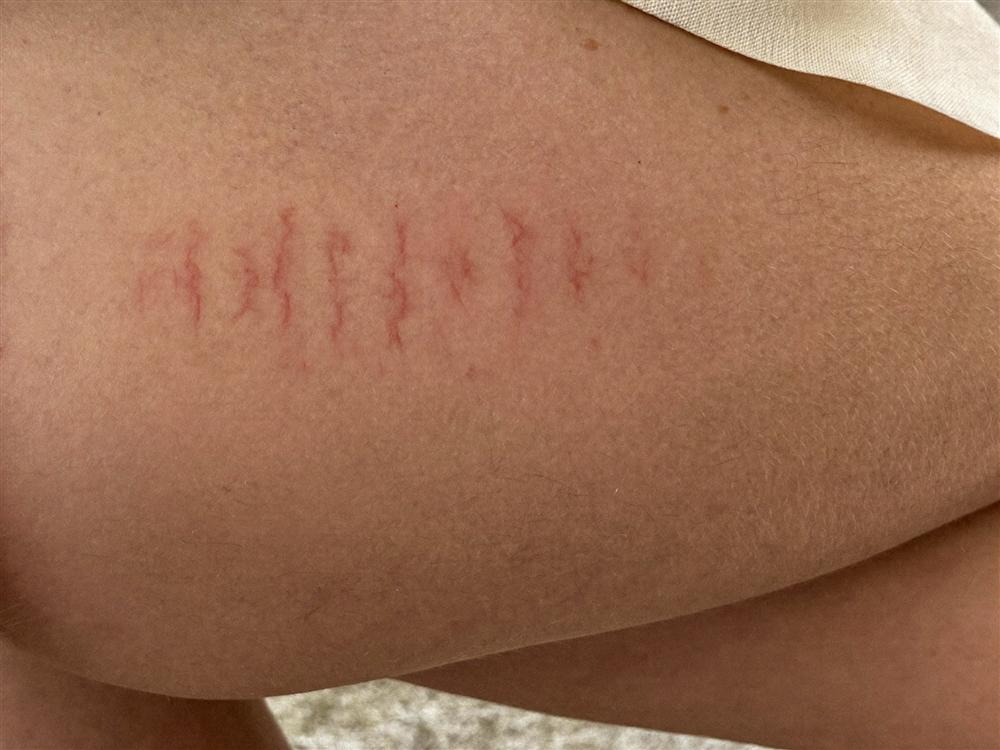 Nora · thighs